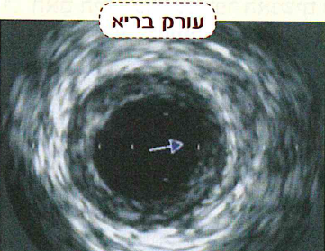 (בספר תמונה:) מודדים קצב לב בעזרת חיישן.
